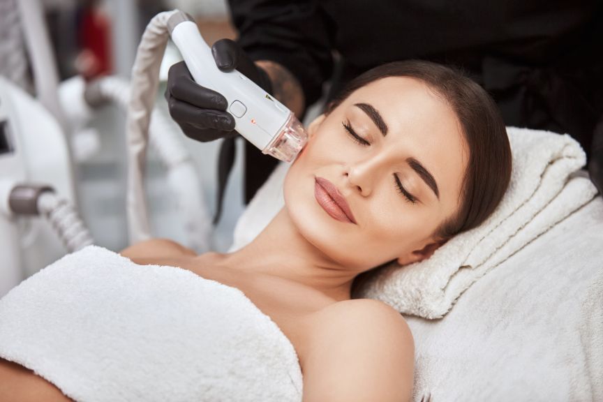 Radiofrekwencja mikroigłowa